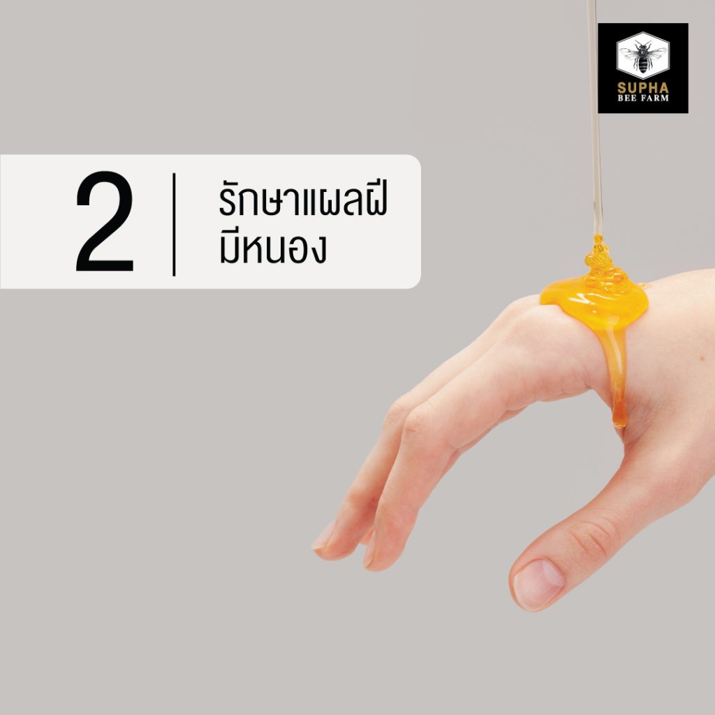 น้ำผึ้งช่วยรักษาแผลฝีมีหนอง