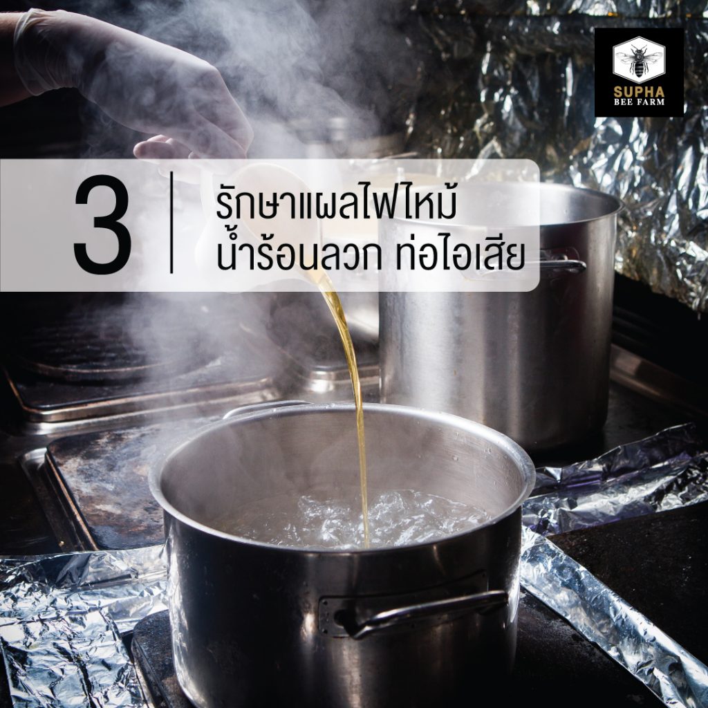 น้ำผึ้งรักษาแผลไฟไหม้ น้ำร้อนลวก