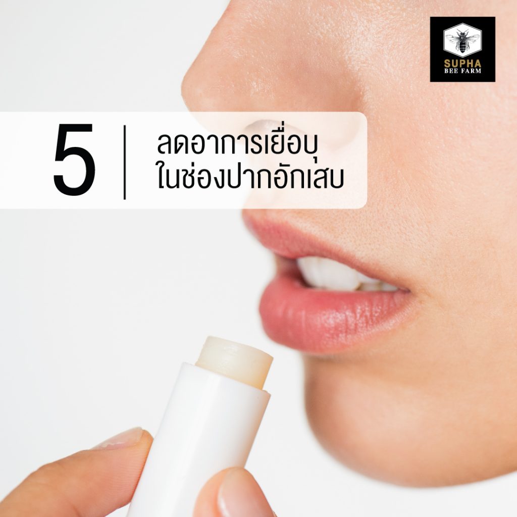 น้ำผึ้งลดอาการเยื่อบุในช่องปากอักเสบ